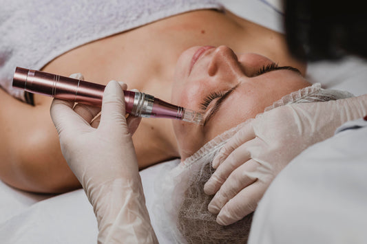 Microneedling 6er Karte + 1 Gratis